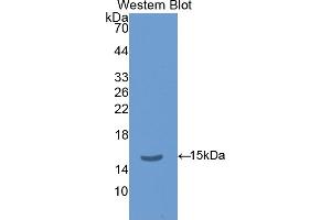 Western blot analysis of the recombinant protein. (TSHB anticorps  (AA 21-138))