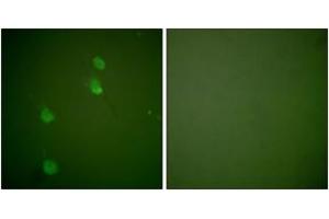 Immunofluorescence analysis of NIH-3T3 cells, using Cullin 2 Antibody. (Cullin 2 anticorps  (AA 696-745))