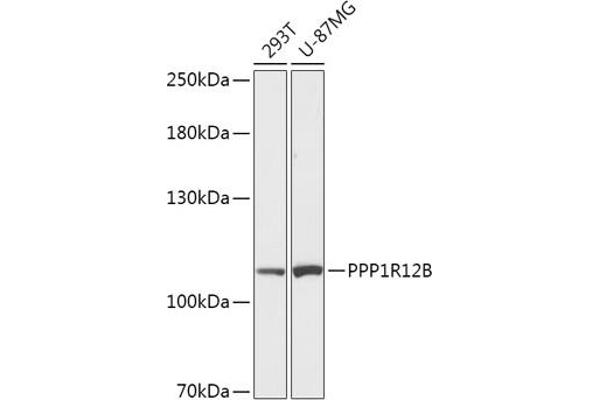 PPP1R12B antibody  (AA 660-930)