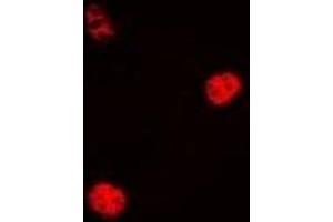 Immunofluorescent analysis of Cyclin C staining in Hela cells. (Cyclin C anticorps)