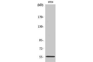 Western Blotting (WB) image for anti-Thioredoxin Reductase 2 (TXNRD2) (C-Term) antibody (ABIN3177808) (TXNRD2 anticorps  (C-Term))