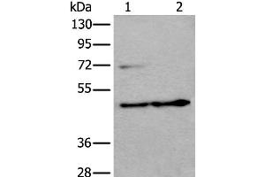 Western blot analysis of HEPG2 cell and Human testis tissue lysates using PRKAR2A Polyclonal Antibody at dilution of 1:550 (PRKAR2A anticorps)