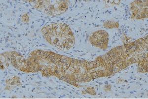 ABIN6266597 at 1/100 staining Human uterus tissue by IHC-P. (MMP7 anticorps  (C-Term))