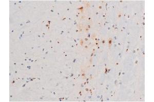 ABIN6267526 at 1/200 staining Mouse brain tissue sections by IHC-P.