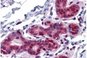 Human Breast: Formalin-Fixed, Paraffin-Embedded (FFPE)