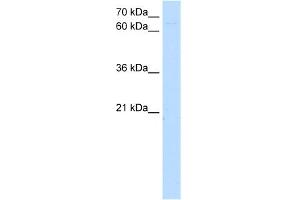 WB Suggested Anti-ZKSCAN1 Antibody Titration:  5. (ZKSCAN1 anticorps  (N-Term))