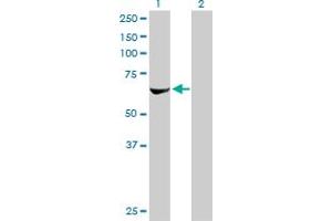 Western Blot analysis of RPS6KB2 expression in transfected 293T cell line by RPS6KB2 monoclonal antibody (M08), clone 4B11.