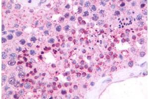 Anti-NMBR antibody IHC staining of human testis. (NMBR anticorps  (Cytoplasmic Domain))