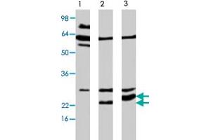 Western blot analysis of extract from Neuro 2a cells, using APH1A polyclonal antibody  . (APH1A anticorps)