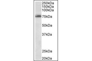 Staining of Jurkat lysate (35µg protein in RIPA buffer) using TSPYL2 antibody at 0. (TSPY-Like 2 anticorps  (Internal Region))