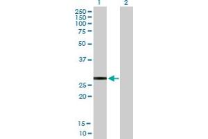 Western Blot analysis of KCNIP2 expression in transfected 293T cell line by KCNIP2 MaxPab polyclonal antibody. (KCNIP2 anticorps  (AA 1-270))