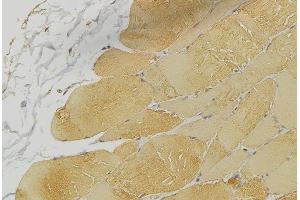 ABIN6269176 at 1/100 staining Mouse muscle tissue by IHC-P.