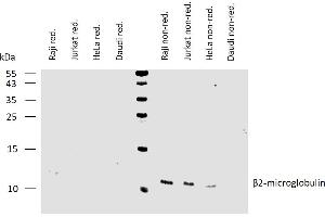 Western blotting analysis of human β2-microglobulin using mouse monoclonal antibody B2M-01 on lysates of various cell lines under reducing and non-reducing conditions. (beta-2 Microglobulin anticorps  (Biotin))