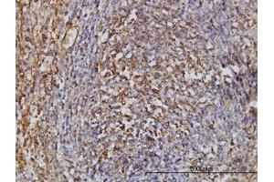 Image no. 1 for anti-Thiopurine S-Methyltransferase (TPMT) (AA 1-246) antibody (ABIN598985) (TPMT anticorps  (AA 1-246))