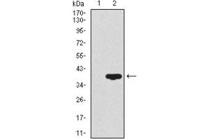 Western Blotting (WB) image for anti-CD59 (CD59) (AA 31-111) antibody (ABIN1845905) (CD59 anticorps  (AA 31-111))