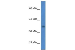 Western Blot showing HSDL1 antibody used at a concentration of 1 ug/ml against HCT15 Cell Lysate (HSDL1 anticorps  (N-Term))