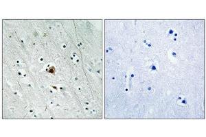 Immunohistochemical analysis of paraffin-embedded human brain tissue using MAPKAPK2 (Phospho-Ser272) antibody (left)or the same antibody preincubated with blocking peptide (right).