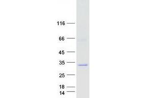 Validation with Western Blot