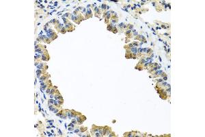 Immunohistochemistry of paraffin-embedded mouse lung using SERPINA3 antibody (ABIN5970399) at dilution of 1/100 (40x lens). (SERPINA3 anticorps)