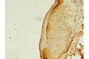 Immunohistochemistry of paraffin-embedded human skin tissue using ABIN7144485 at dilution of 1:100 (APAF1 anticorps  (AA 104-415))