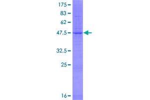 Image no. 1 for Phosphatidylethanolamine N-Methyltransferase (PEMT) (AA 1-236) protein (GST tag) (ABIN1314651)