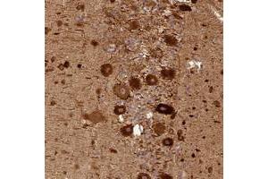 Immunohistochemical staining of human cerebellum with BCDIN3D polyclonal antibody  shows strong cytoplasmic positivity in purkinje cells at 1:50-1:200 dilution. (BCDIN3D anticorps)