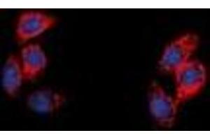 Immunofluorescent analysis of NPY5R staining in A549 cells.