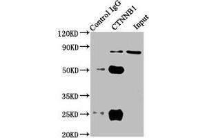 Immunoprecipitating CTNNB1 in HT29 whole cell lysate Lane 1: Rabbit control IgG instead of ABIN7146984 in HT29 whole cell lysate.