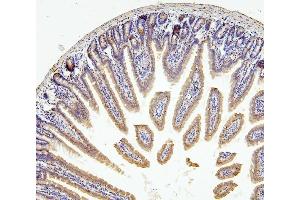 IHC analysis of RNF169 using anti-RNF169 antibody (ABIN6719530).
