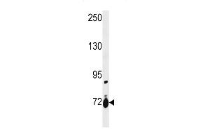SLC28A1 Antibody (Center) (ABIN1881811 and ABIN2843229) western blot analysis in ZR-75-1 cell line lysates (35 μg/lane). (SLC28A1 anticorps  (AA 381-409))
