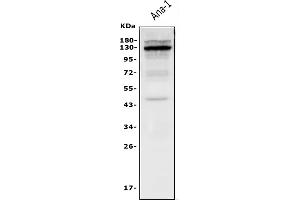 Western blot analysis of CSF2RB using anti-CSF2RB antibody (ABIN7601088).
