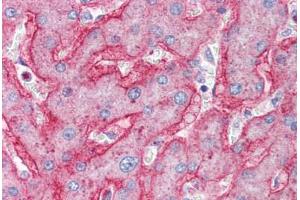 Human Liver (formalin-fixed, paraffin-embedded) stained with ENPP1 antibody ABIN337063 at 2. (ENPP1 anticorps  (AA 915-925))