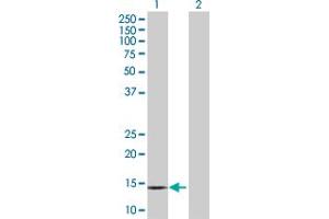 Lane 1: PPBP transfected lysate ( 13. (PPBP 293T Cell Transient Overexpression Lysate(Denatured))
