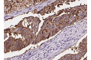ABIN6268717 at 1/100 staining Human lung tissue by IHC-P. (Aquaporin 5 anticorps  (C-Term))