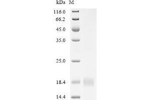 Integrin beta 1 (ITGB1) (AA 752-798) protein (His tag)