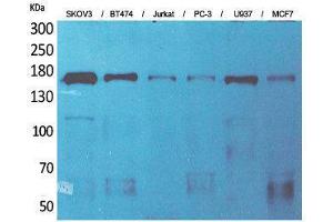 Western Blotting (WB) image for anti-Sterol Carrier Protein 2 (SCP2) (Internal Region) antibody (ABIN3187668)