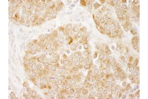 Immunohistochemistry (IHC) image for anti-Insulin Receptor Substrate 1 (IRS1) (AA 1192-1242) antibody (ABIN7448979)