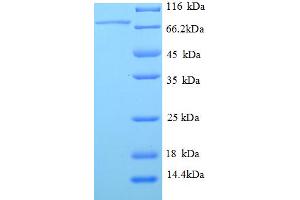 SDS-PAGE (SDS) image for serpin Peptidase Inhibitor, Clade F (Alpha-2 Antiplasmin, Pigment Epithelium Derived Factor), Member 1 (SERPINF1) (AA 21-418) protein (GST tag) (ABIN5710348)