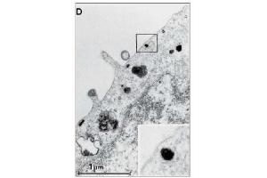 Immunohistochemistry (IHC) image for anti-Epidermal Growth Factor Receptor (EGFR) (Extracellular Domain) antibody (ABIN492657) (EGFR anticorps  (Extracellular Domain))