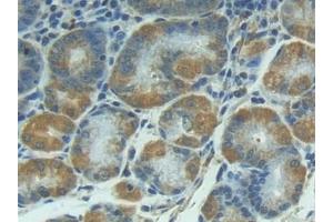 Detection of IL1R1 in Human Stomach Tissue using Polyclonal Antibody to Interleukin 1 Receptor Type I (IL1R1)