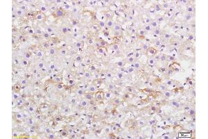 Formalin-fixed and paraffin embedded rat liver labeled with Anti-CKLF Polyclonal Antibody, Unconjugated (ABIN739650) at 1:200, followed by conjugation to the secondary antibody and DAB staining