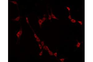 ABIN6275025 staining HuvEc by IF/ICC. (CCDC102B anticorps  (Internal Region))