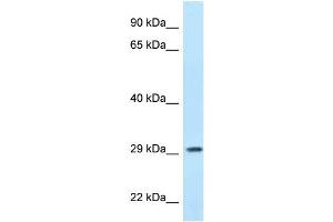 WB Suggested Anti-PPP1R3B Antibody Titration: 1. (PPP1R3B anticorps  (N-Term))