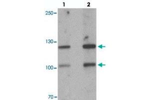 Western blot analysis of CRB2 in rat brain tissue with CRB2 polyclonal antibody  at 1 ug/mL. (CRB2 anticorps  (Internal Region))