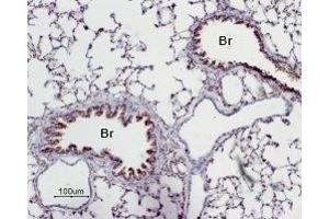 Expression of Adenosine A2A Receptor in rat lung - Immunohistochemical staining of paraffin emedded rat lung sections using Anti-Adenosine A2A Receptor Antibody (ABIN7042883, ABIN7043888 and ABIN7043889), (1:50).