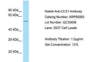 Western Blotting (WB) image for anti-CCZ1 Vacuolar Protein Trafficking and Biogenesis Associated Homolog (S. Cerevisiae) (CCZ1) (C-Term) antibody (ABIN2790029)