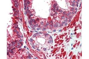 TFAP2C antibody was used for immunohistochemistry at a concentration of 4-8 ug/ml.