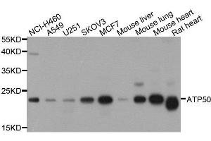 Western blot analysis of extracts of various cell lines, using ATP5O antibody. (ATP5O anticorps  (AA 24-213))