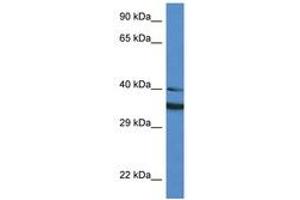 Image no. 1 for anti-NAD(P)H Dehydrogenase, Quinone 1 (NQO1) (AA 111-160) antibody (ABIN6747304) (NQO1 anticorps  (AA 111-160))