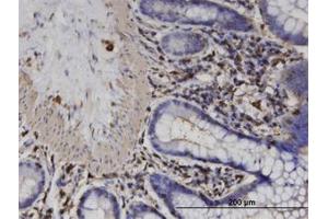 Image no. 1 for anti-Actin-Related Protein T2 (ACTRT2) (AA 209-300) antibody (ABIN599611) (ACTRT2 anticorps  (AA 209-300))